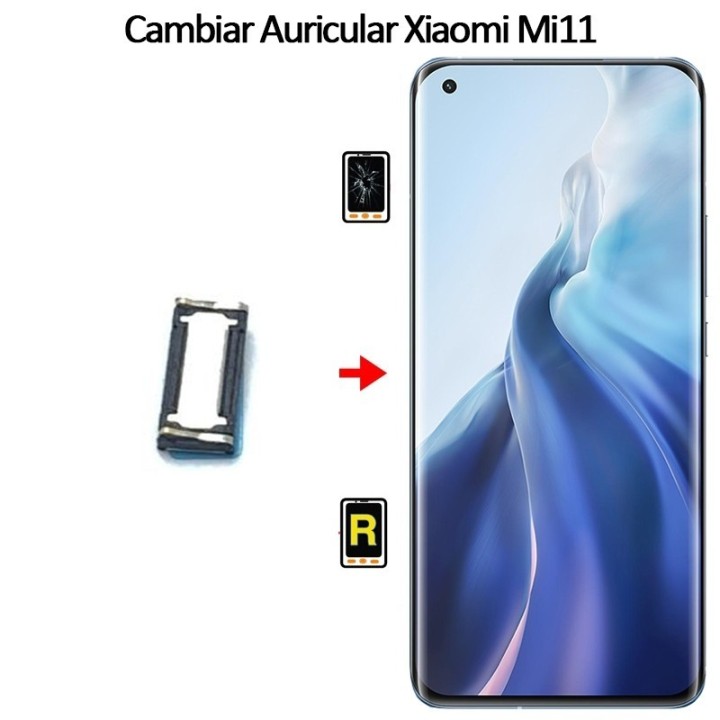 Cambiar Auricular De Llamada Xiaomi Mi 11 5G